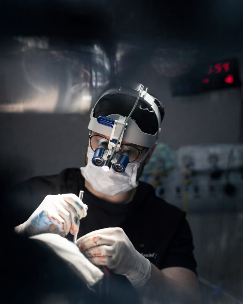 Transplante Capilar